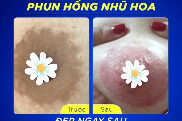 Thu Nhỏ Nhũ Hoa